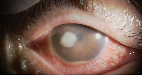 病名から調べる