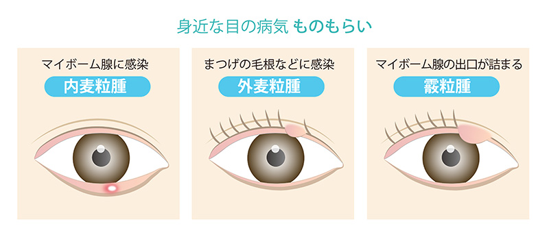 症状から調べる