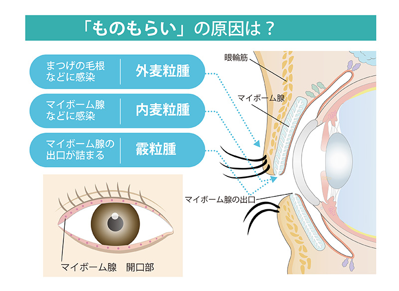 症状から調べる