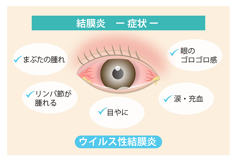 症状から調べる